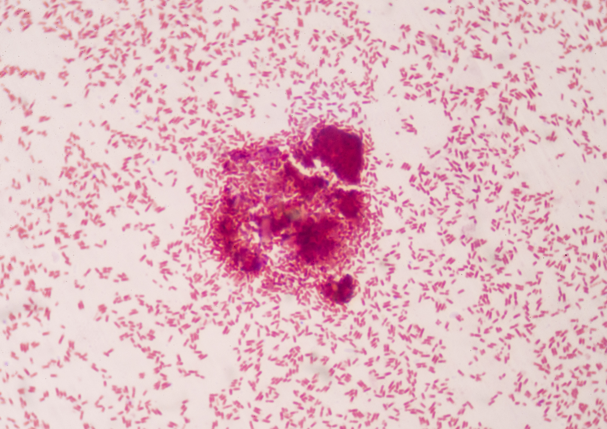 How D7 Chemistry Works Against Common Food Processing Bacteria